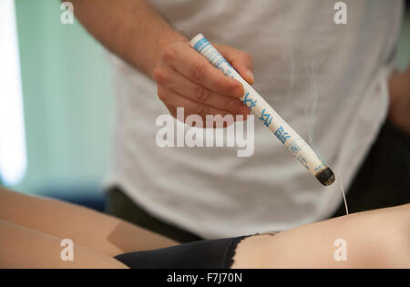 Reportage sur un thérapeute qui se spécialise dans la médecine traditionnelle chinoise. Le thérapeute combine les avantages de l'aiguilles avec la moxibustion. Banque D'Images