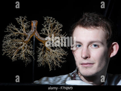 Edinburgh, Royaume-Uni. 2e décembre. Exposition met en évidence l'anatomie du corps et l'extérieur. L'Université d'édimbourg afficher une remarquable pièce highlinting détails des poumons humains. Photo Doug Stevens commissaire de l'exposition. Pako Mera/Alamy Live News. Banque D'Images