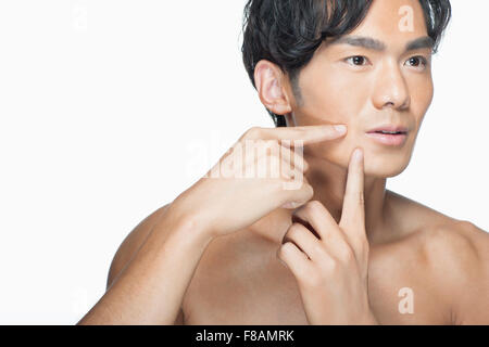 Portrait of Asian man squeezing un bouton sur son visage avec les doigts Banque D'Images