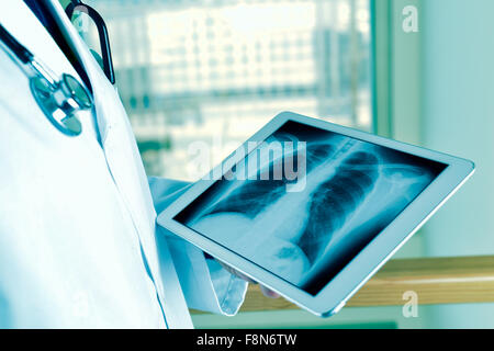 Libre d'un jeune homme portrait l'observation d'une radiographie thoracique dans un ordinateur tablette Banque D'Images