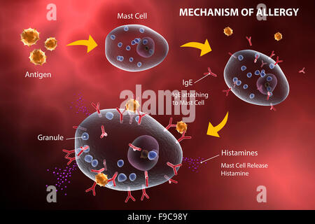 Libération de l'histamine de cellules de mât en raison de la réaction allergique. Banque D'Images