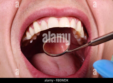 Jeune homme ayant ses dents examinées, Close up Banque D'Images