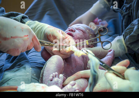 C section. L'équipe chirurgicale l'exécution de l'opération de chirurgie en maternité. Banque D'Images