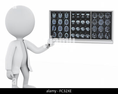 3d white personnes médecin avec films cerveau crânien Banque D'Images