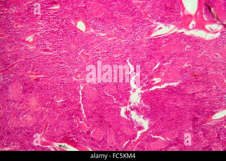 Des tissus du pancréas sous le microscope. Banque D'Images