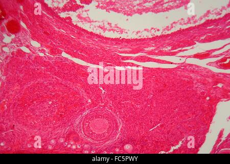 Les tissus de l'ovaire sous le microscope. Banque D'Images