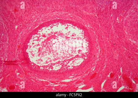 Les tissus de l'ovaire sous le microscope. Banque D'Images