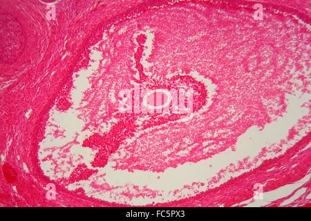 Les tissus de l'ovaire sous le microscope. Banque D'Images