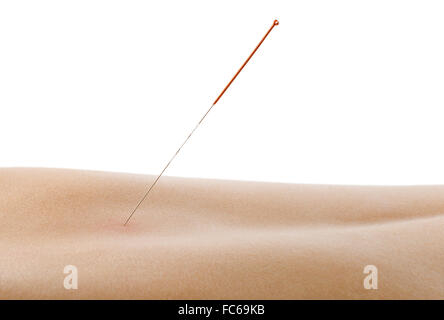 acupuncture Banque D'Images