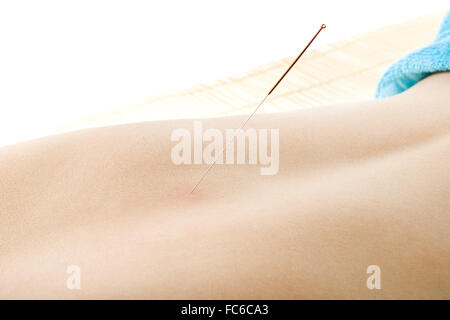 acupuncture Banque D'Images