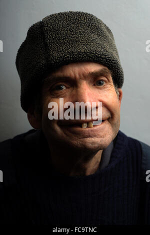 Homme avec des problèmes de santé de métal vivant avec un cancer de la gorge inopérable Banque D'Images