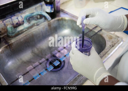 Ouanaminthe, Haïti. Jan 11, 2016. 11 janvier 2016 - Haïti Ouanaminthe, - un technicien de laboratoire à la Santre Medico de Ouanaminthe, Haïti, prépare le paludisme les lames dans un puits à l'installation. Ces centres de santé sont en première ligne de surveillance du paludisme et la prévention dans le nord-est de Haïti. © David Snyder/ZUMA/Alamy Fil Live News Banque D'Images