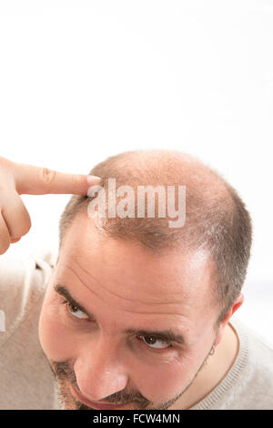 40s l'homme avec une calvitie naissante , close-up, fond blanc Banque D'Images