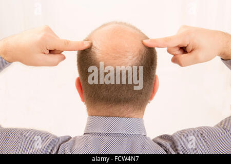 40s l'homme avec une calvitie naissante , close-up, fond blanc Banque D'Images