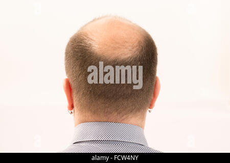 40s l'homme avec une calvitie naissante , close-up, fond blanc Banque D'Images