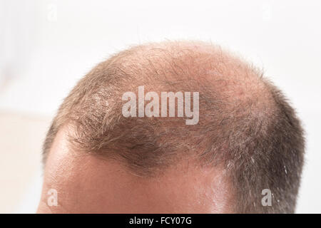 40s l'homme avec une calvitie naissante , close-up, fond blanc Banque D'Images