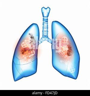 Les poumons avec les mécanismes. Santé et médecine Banque D'Images