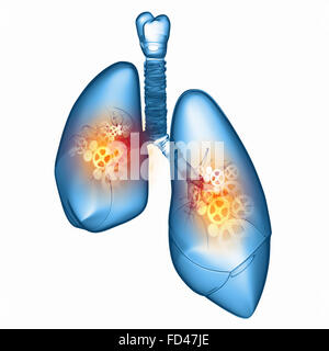 Les poumons avec les mécanismes. Santé et médecine Banque D'Images