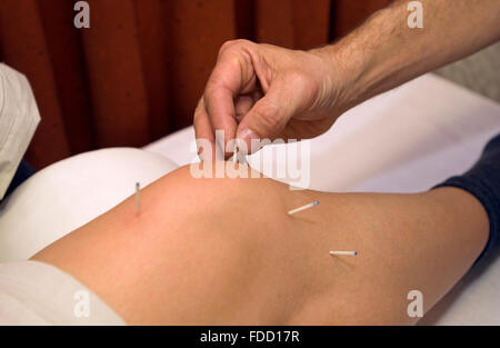Médecin utilise les aiguilles d'acupuncture sur le genou d'une femme Banque D'Images