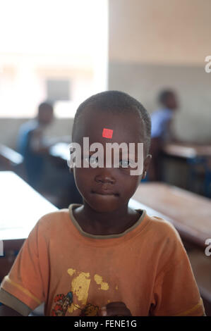 Mali, Afrique - Août 2009 - Closeup portrait d'un élève de l'école primaire de l'Afrique noire avec un vaccin stick sur sa face avant Banque D'Images