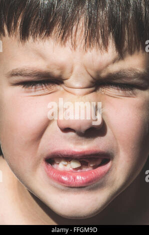 Enfant montre des dents manquantes. Visage de l'enfant Banque D'Images