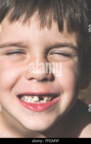 Enfant montre des dents manquantes. Visage de l'enfant Banque D'Images