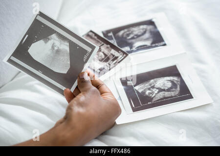 Le féminin hands holding ultrasound images Banque D'Images