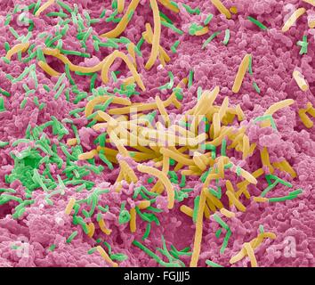 Les bactéries de la langue. Couleur de l'analyse des électrons Microphotographie (SEM) de bactéries sur la surface d'une langue humaine. Un grand nombre de Banque D'Images