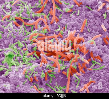 Les bactéries de la langue. Couleur de l'analyse des électrons Microphotographie (SEM) de bactéries sur la surface d'une langue humaine. Un grand nombre de Banque D'Images