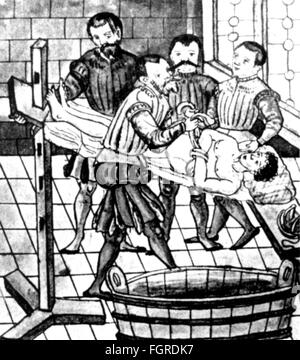 Médecine, chirurgie, hernie, literie et fixation du patient, hors de: Caspar Stromayr (+ 1566 / 1567), 'Practica copiosa', Lindau, 1559, droits additionnels-Clearences-non disponible Banque D'Images