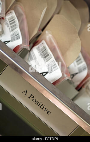 Sacs de 'A' dans le sang positif laboratoire de pathologie à l'hôpital. Banque D'Images