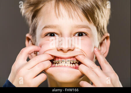 Studio portrait of white boy with braces Banque D'Images