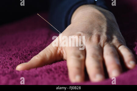 Berlin, Allemagne. Feb 25, 2016. Une aiguille d'acupuncture appliquée à une part à Berlin, Allemagne, 25 février 2016. Photo : JENS KALAENE/dpa/Alamy Live News Banque D'Images