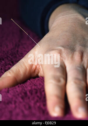 Berlin, Allemagne. Feb 25, 2016. Une aiguille d'acupuncture appliquée à une part à Berlin, Allemagne, 25 février 2016. Photo : JENS KALAENE/dpa/Alamy Live News Banque D'Images