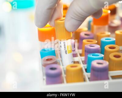 Technicien de laboratoire, la préparation de l'échantillon pour la chimie en laboratoire d'analyses médicales Banque D'Images