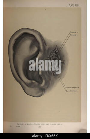 Anatomie chirurgicale de la tête et du cou par Deaver, John B. (John Blair), 1855-1931 Banque D'Images