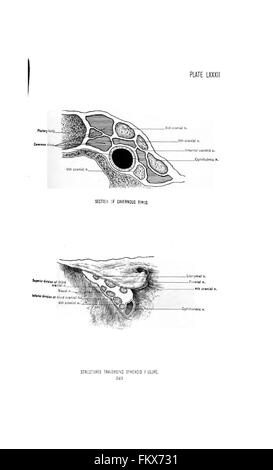 Anatomie chirurgicale de la tête et du cou par Deaver, John B. (John Blair), 1855-1931 Banque D'Images