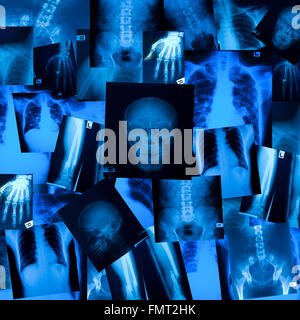 X ray film historique Banque D'Images