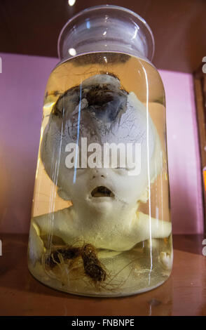 Naples, Italie. 14Th Mar, 2016. Musée anatomique, la deuxième plus ancienne université de Naples, est ouvert au public. © Salvatore Laporta/Pacific Press/Alamy Live News Banque D'Images