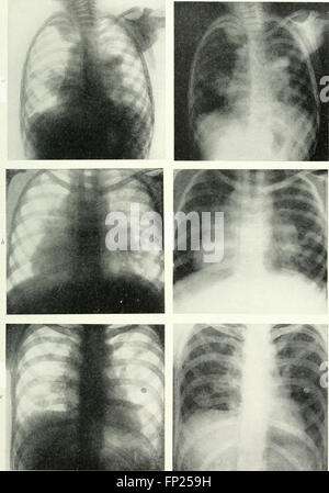 La radiographie, la thérapeutique des rayons x et le radium thérapie (1915)