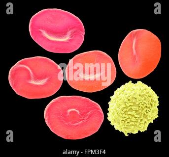 Les cellules sanguines. Couleur de l'analyse - Microphotographie (SEM) de globules rouges (érythrocytes rouge) un des lymphocytes (globules blancs Banque D'Images