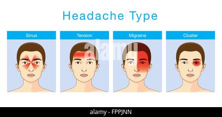 Type de maux de tête Illustration de Vecteur