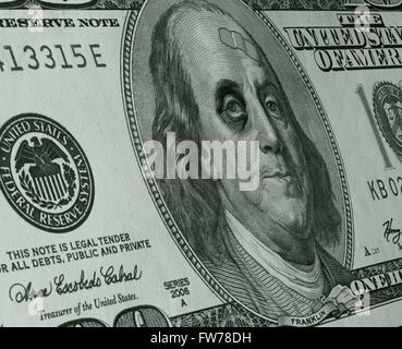 Ben Franklin sports un oeil noir et bandage sur le visage d'une US One Hundred Dollar Bill illustrant une faiblesse du dollar des États-Unis. Banque D'Images