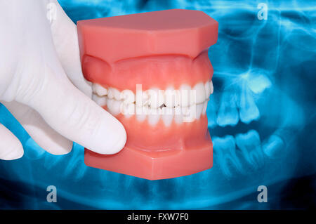 Dentiste dentaire blanc montrent la main modèle sur la radiographie à rayons x Banque D'Images