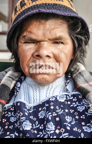 Visages de Bolivie - 14/08/2013 - Bolivie / Sucre (Bolivie) / Sucre (Bolivie) - Les résidents de l'Hospice de Santa Rita dans Sucre. Banque D'Images