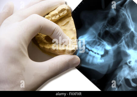 Dentiste part voir les molaires sur un x-ray Banque D'Images