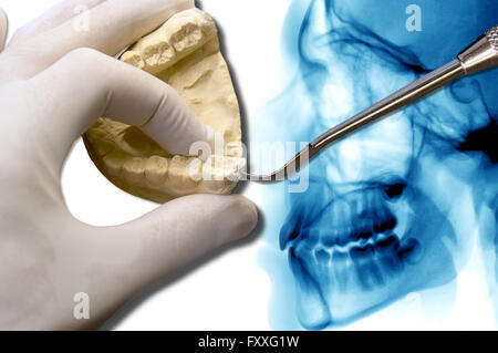 Dentiste montrent les molaires sur x-ray scanner dentaire Banque D'Images