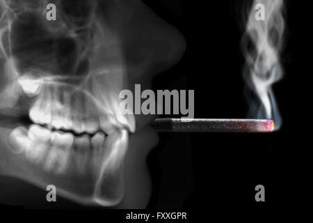 La fumée de cigarette radiographie Banque D'Images