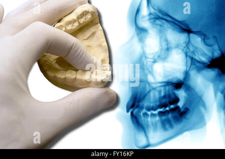 Dentiste part afficher plus de molaires céphalométrique analyse dentaire Banque D'Images