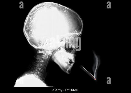 Cigarette radiographie Banque D'Images